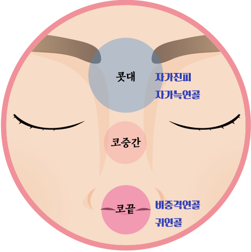 무보형물 코성형이란? 자가진피, 늑연골, 귀연골, 비중격연골 알아보기 관련 이미지 1