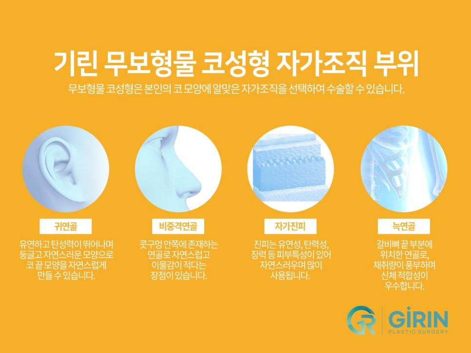 여자코성형후기 얼굴 비율까지 고려하여 관련 이미지 7