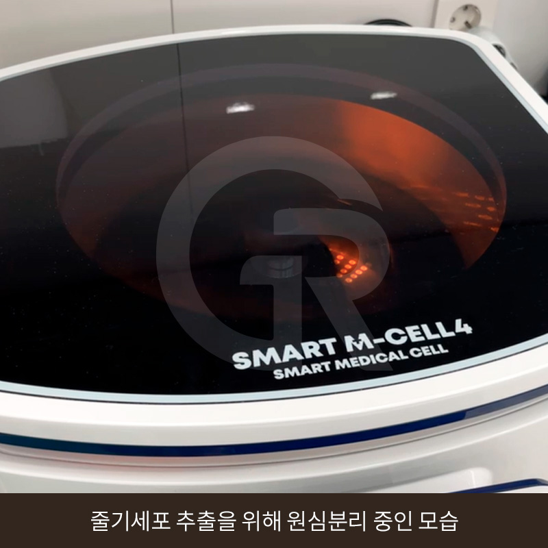 탈모 고민 두피 줄기세포 치료, 가격이 다른 이유는? 관련 이미지 4