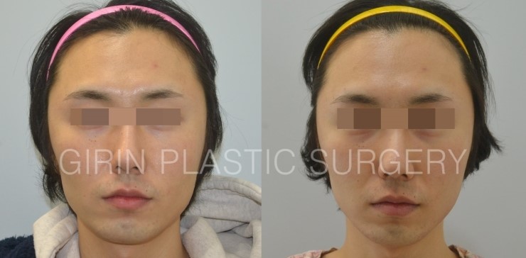 뉴브이라인 6주차 관련 이미지 1