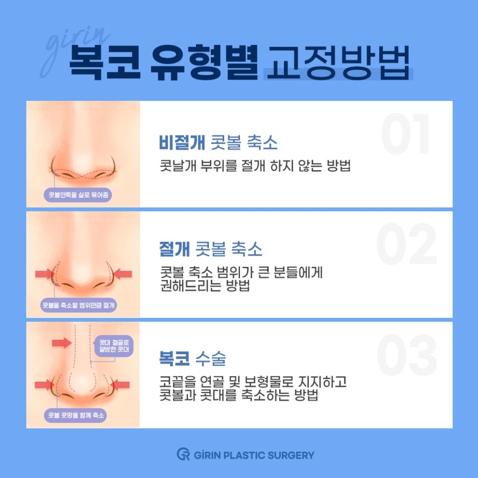 콧대높이기? 관련 이미지 10
