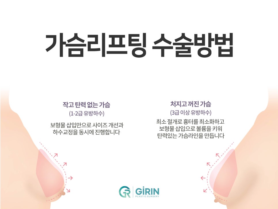 가슴거상술 흉터에 대한 걱정은 관련 이미지 2