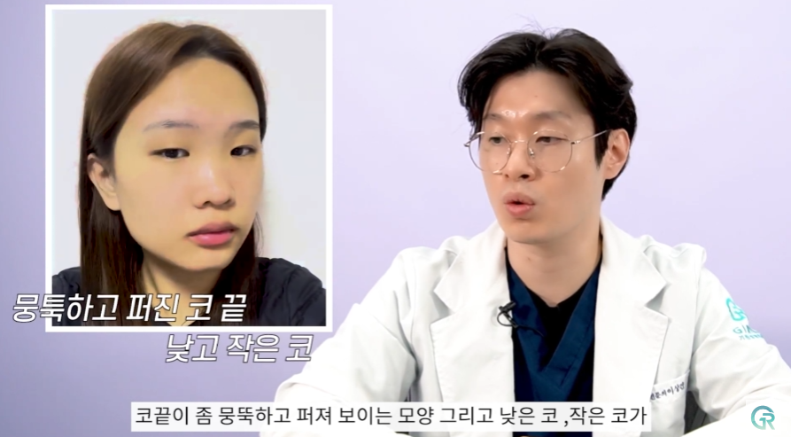 [기린성형외과] 작고 답답한 눈, 뭉뚝하고 낮은 복코 탈출!_눈성형, 코성형 수술일지 관련 이미지 6