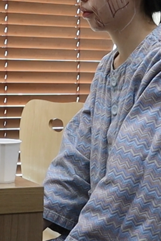 일요일에도 리프팅 가능한 이유 기린성형외과 관련 이미지 5