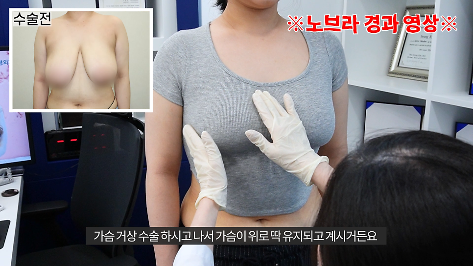 [기린성형외과]가슴거상_처진가슴 자가 진단법 및 수술법 관련 이미지 10