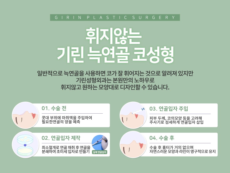 낮은코수술 원하는 라인으로 관련 이미지 5
