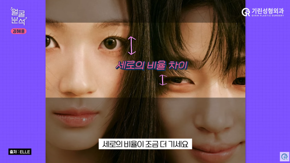 [기린성형외과의원] 선재 업고 튄 임솔 비주얼_선업튀 2탄 김혜윤 얼굴분석 관련 이미지 3