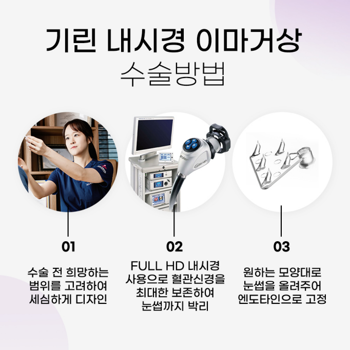 이마거상수술 주름을 개선하는 관련 이미지 5