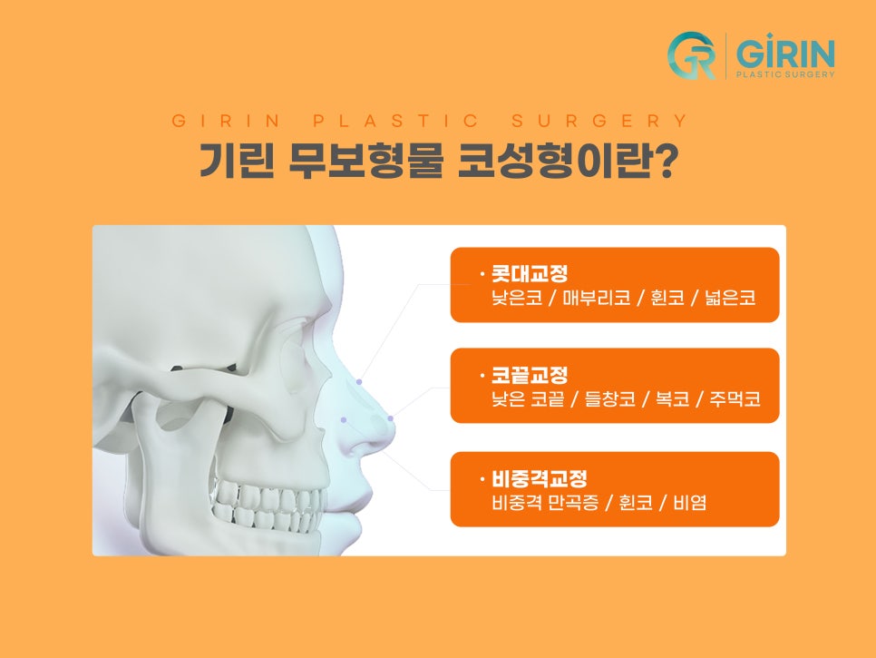 무보형물 코수술 자연스러운 코라인 관련 이미지 3