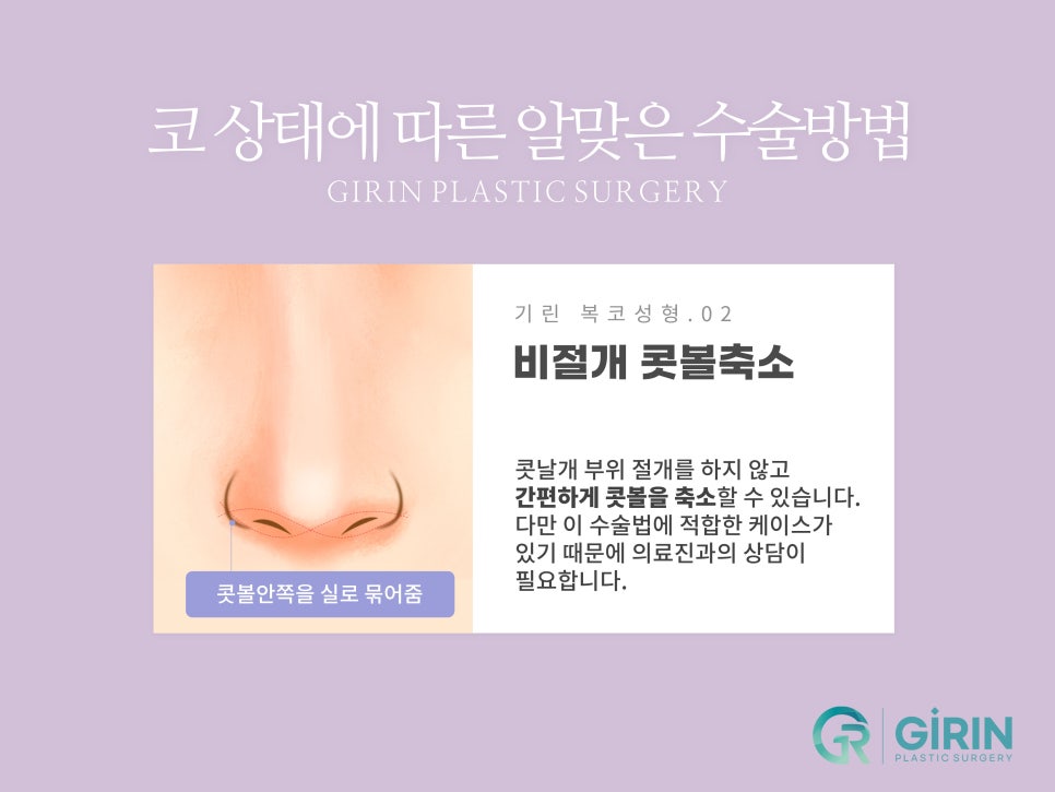 복코성형후기 세련미 있는 코 원한다면 관련 이미지 8