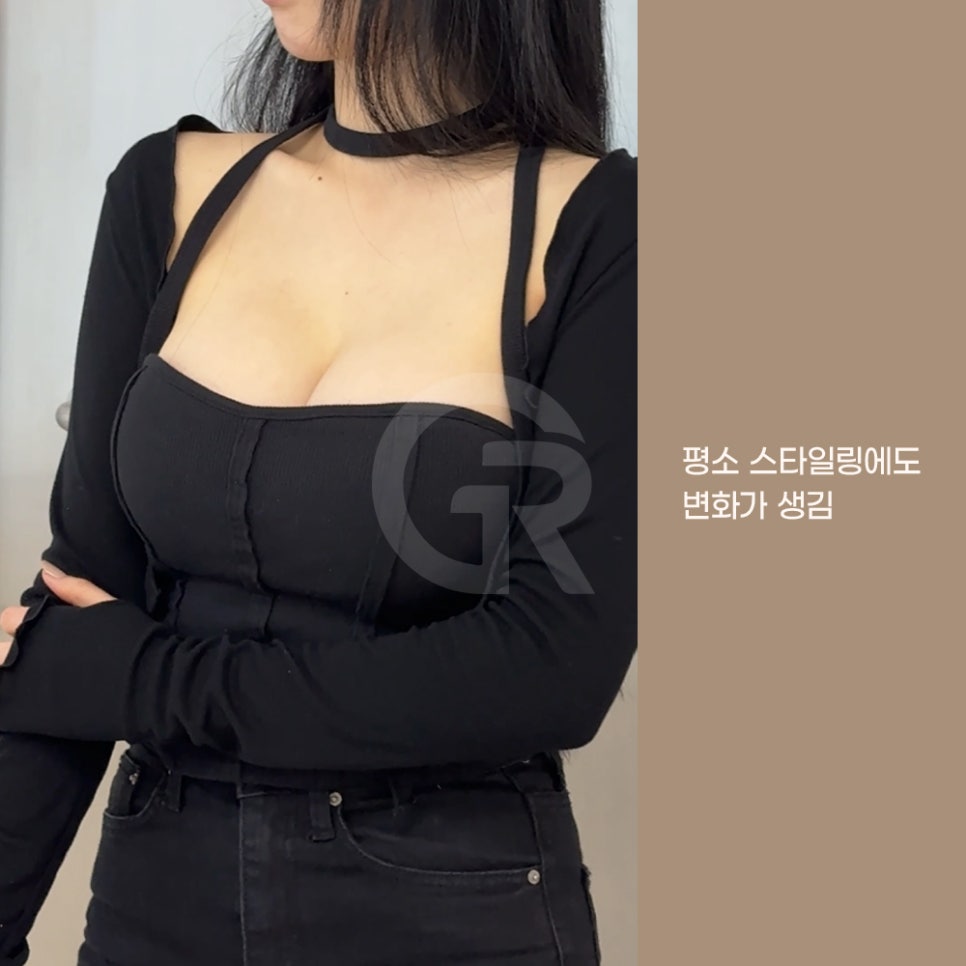 기린성형외과 가슴성형 패션 인플루언서의 고민 해결 관련 이미지 10