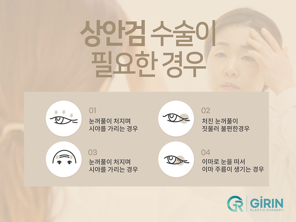 처진눈성형 다시 눈매를 잡아주며 관련 이미지 4