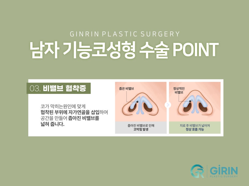 남자코성형잘하는곳 자연스러운 모습은 관련 이미지 7