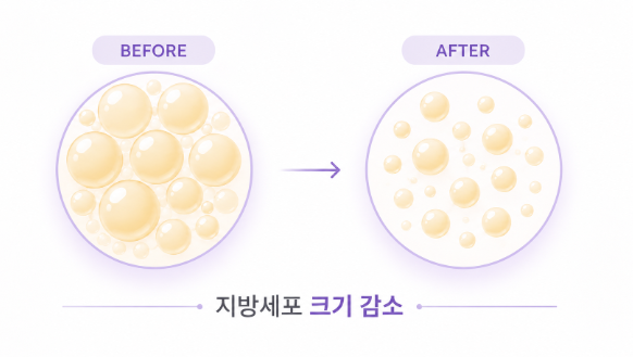 지방분해주사란? 효과와 얼굴 적용 부위 알아보기 관련 이미지 3