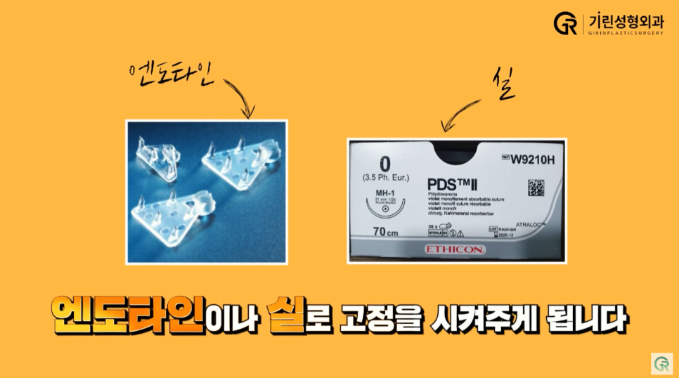 [기린성형외과] 어제보다 오늘 더 젊어지는 기린 이마거상_이마거상 Q&A 관련 이미지 8