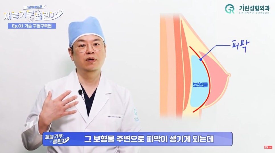 가슴재수술? 관련 이미지 5