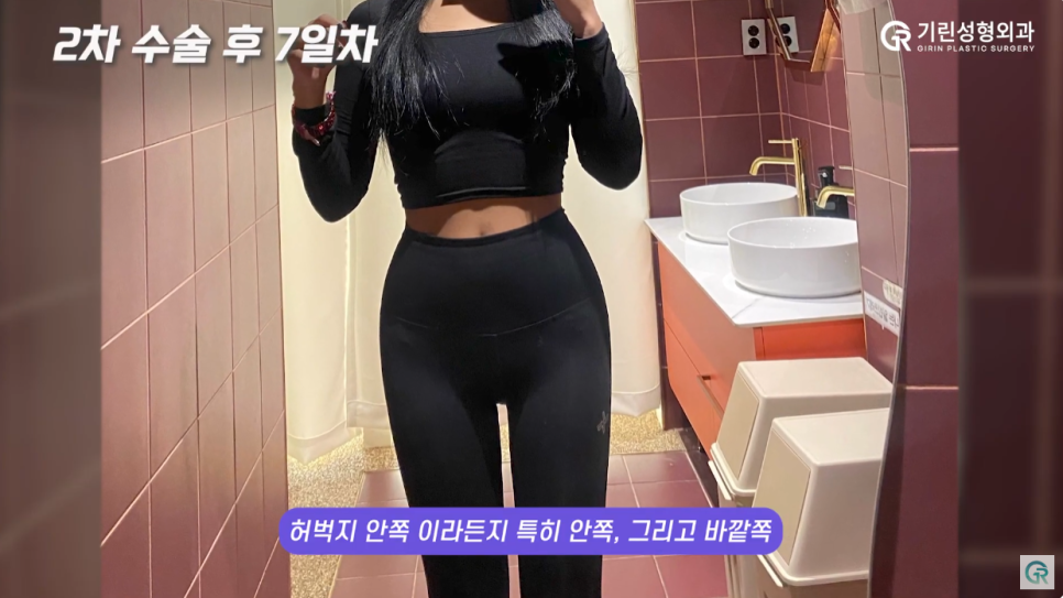 [기린성형외과의원] 빼고 싶은 부위는 빼고, 넣고 싶은 부위에 넣는 지방이식 수술일지 관련 이미지 7