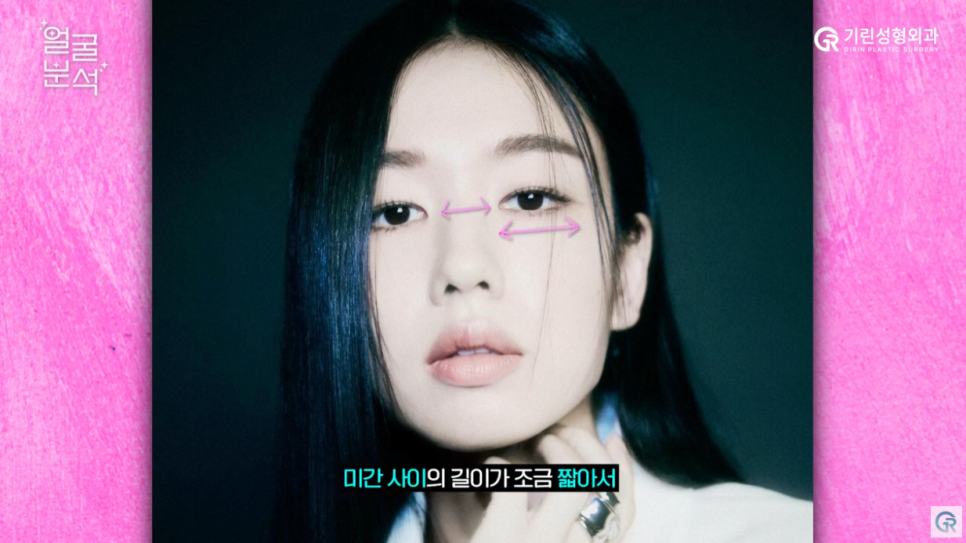 [기린성형외과의원]_자매 아닌가요? 안유진, 정소민, 안은진 얼굴분석 관련 이미지 7