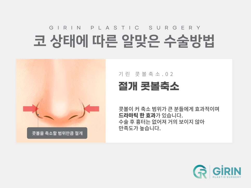 콧볼축소수술후기 주의한 점은 관련 이미지 5