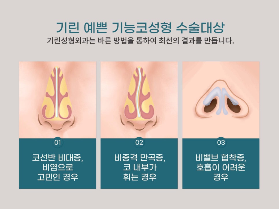 기능코수술 불편함을 해결하자 관련 이미지 4