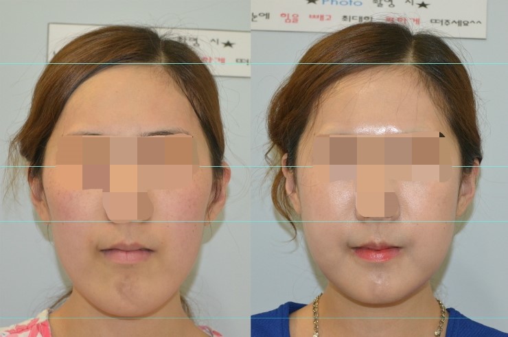 긴곡선을 통한 길이줄임 3주차 관련 이미지 1