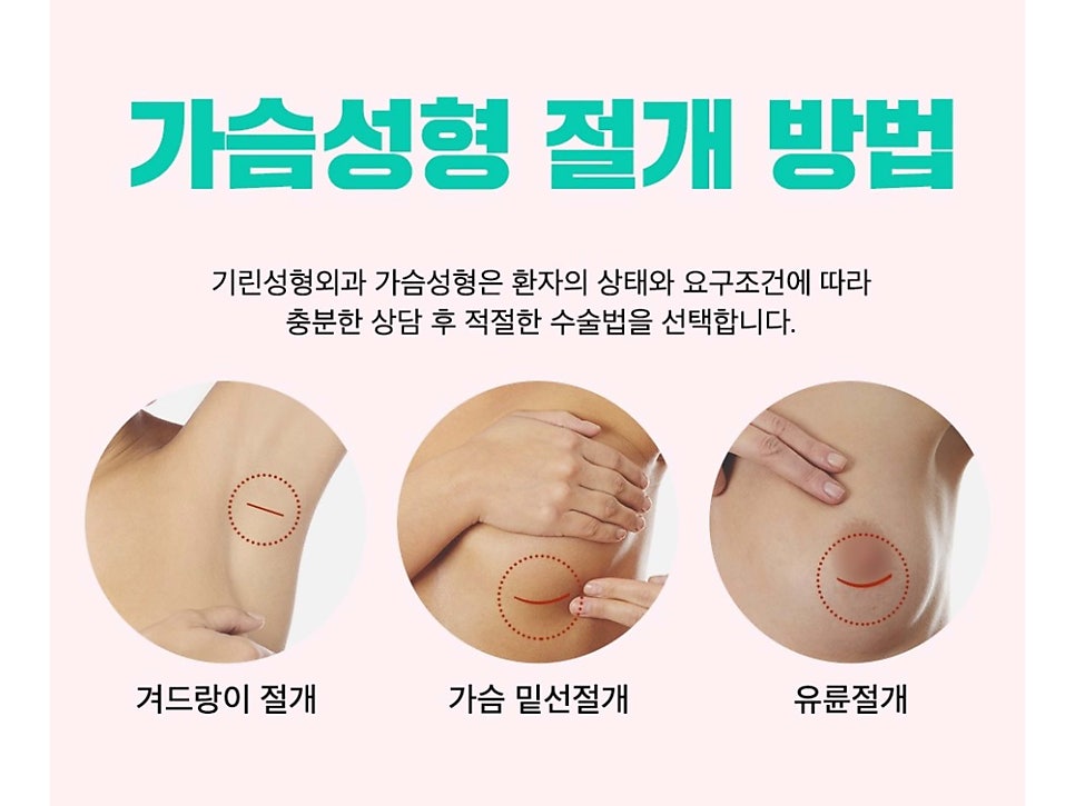가슴성형전후 비교가 필요하다면 관련 이미지 4