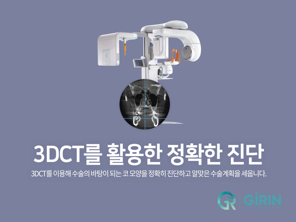 매부리코수술후기 방법까지 확인해 관련 이미지 6