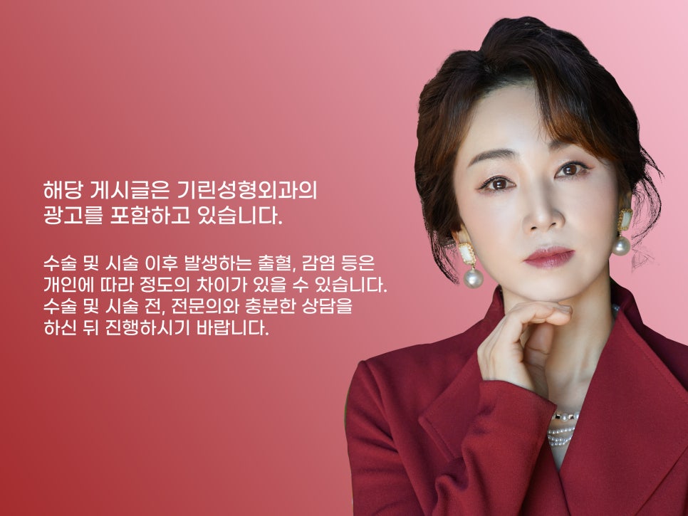 중년눈수술 어려지는 방법 중 하나? 관련 이미지 16