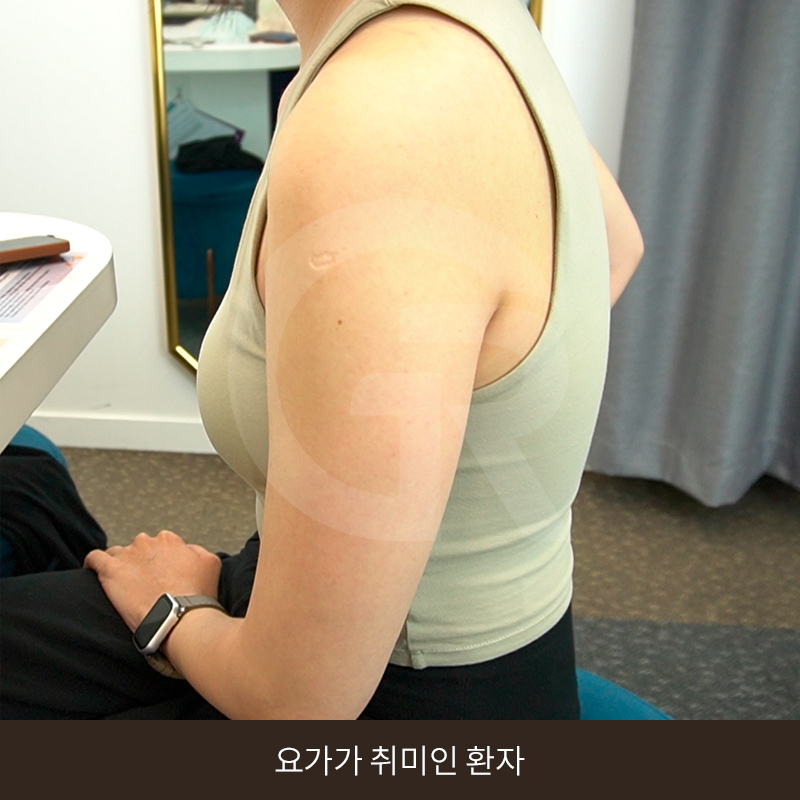 요가로 소용없던 굵은 팔뚝 지방흡입 수술 후기 관련 이미지 3