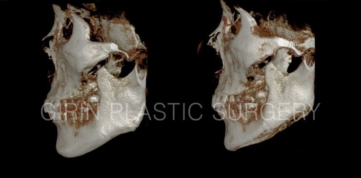 뉴브이라인 6주차 관련 이미지 4