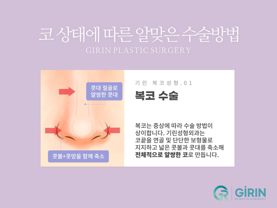 복코성형후기 세련미 있는 코 원한다면 관련 이미지 7