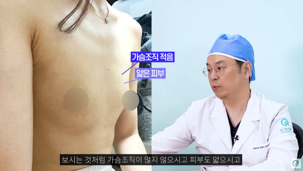 [기린성형외과의원] 자연스럽고 만족스러운 결과_마른체형의 가슴성형 수술일지 관련 이미지 3