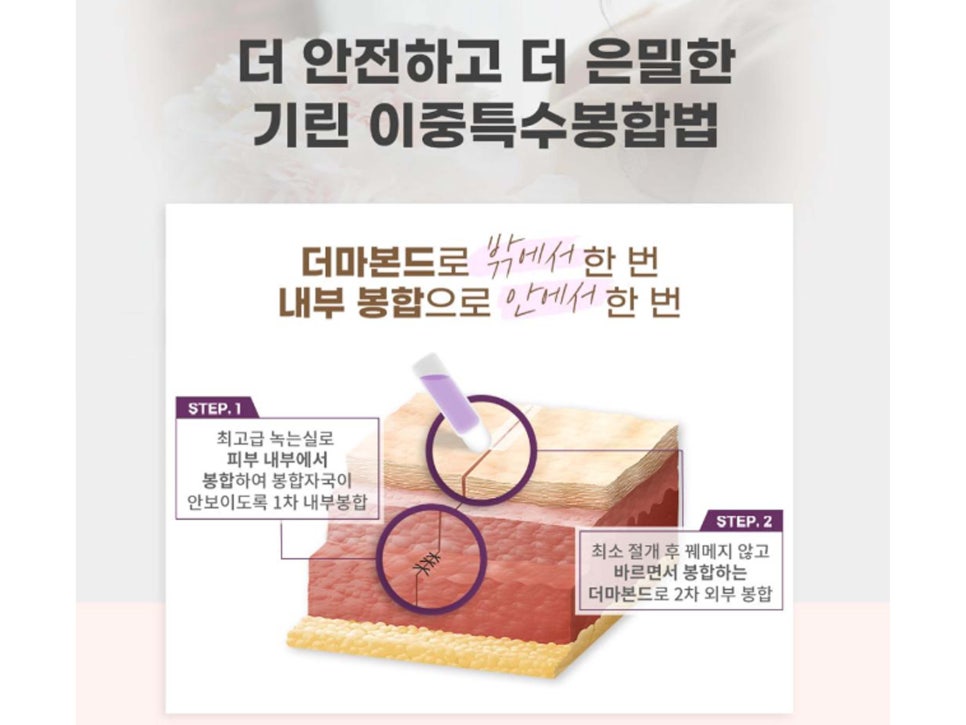 멘토가슴성형 차이를 알고 선택해야 관련 이미지 12