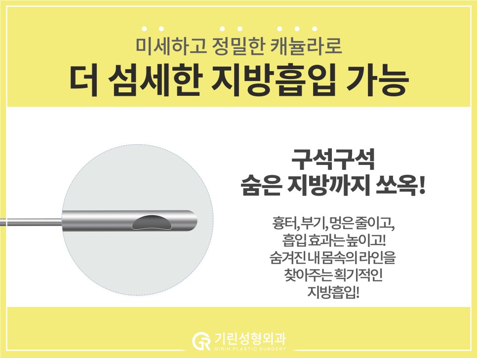 [기린 성형외과] 예쁜 라인 찾는 체형별 팔뚝지방흡입 관련 이미지 12