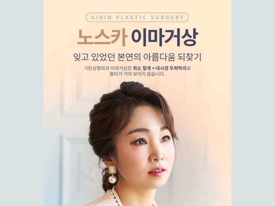 이마거상수술 주름을 개선하는 관련 이미지 1