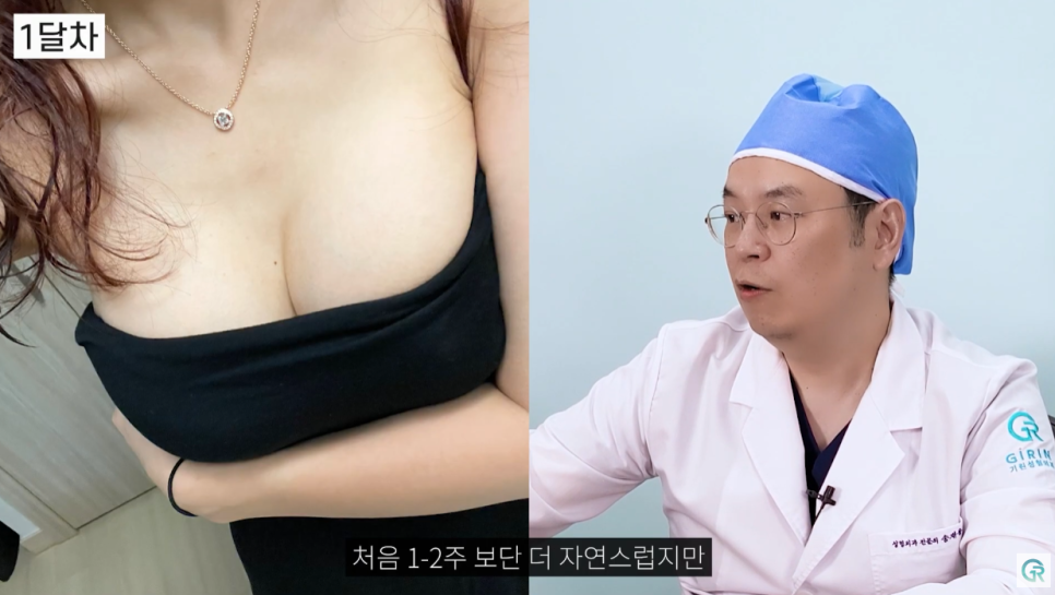 [기린성형외과의원] 자연스럽고 만족스러운 결과_마른체형의 가슴성형 수술일지 관련 이미지 8