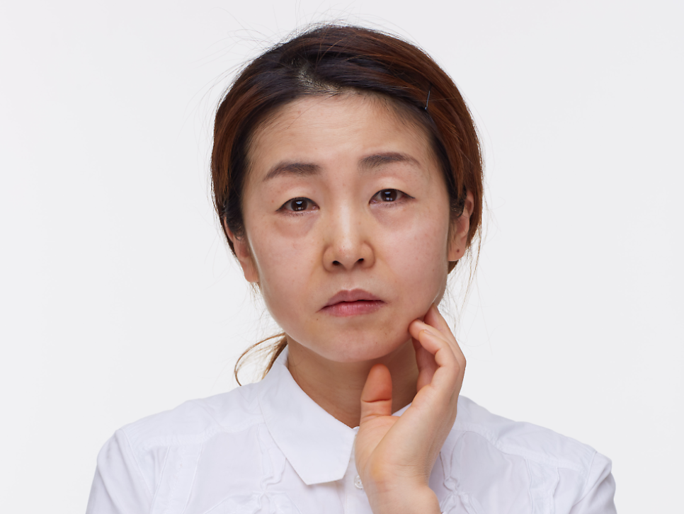 처진눈성형 다시 눈매를 잡아주며 관련 이미지 1