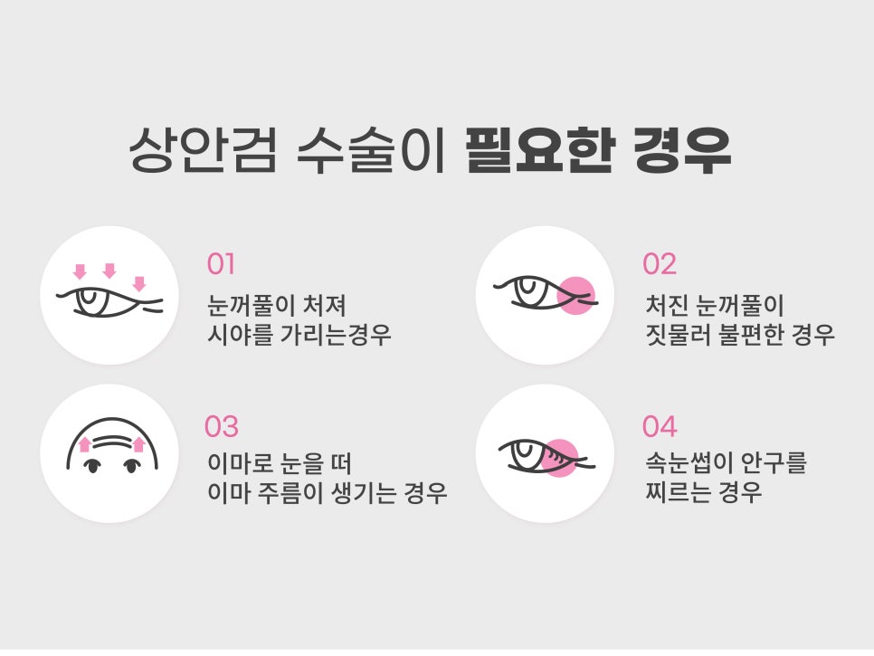 중년눈수술 어려지는 방법 중 하나? 관련 이미지 6