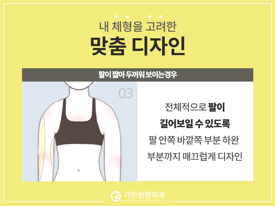 [기린 성형외과] 예쁜 라인 찾는 체형별 팔뚝지방흡입 관련 이미지 7
