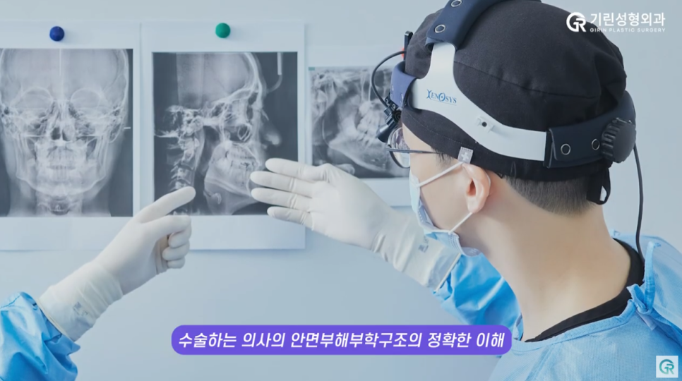 [기린성형외과의원] 턱관절장애 안면비대칭 미용목적 양악수술_구강악안면외과 전문의 관련 이미지 11