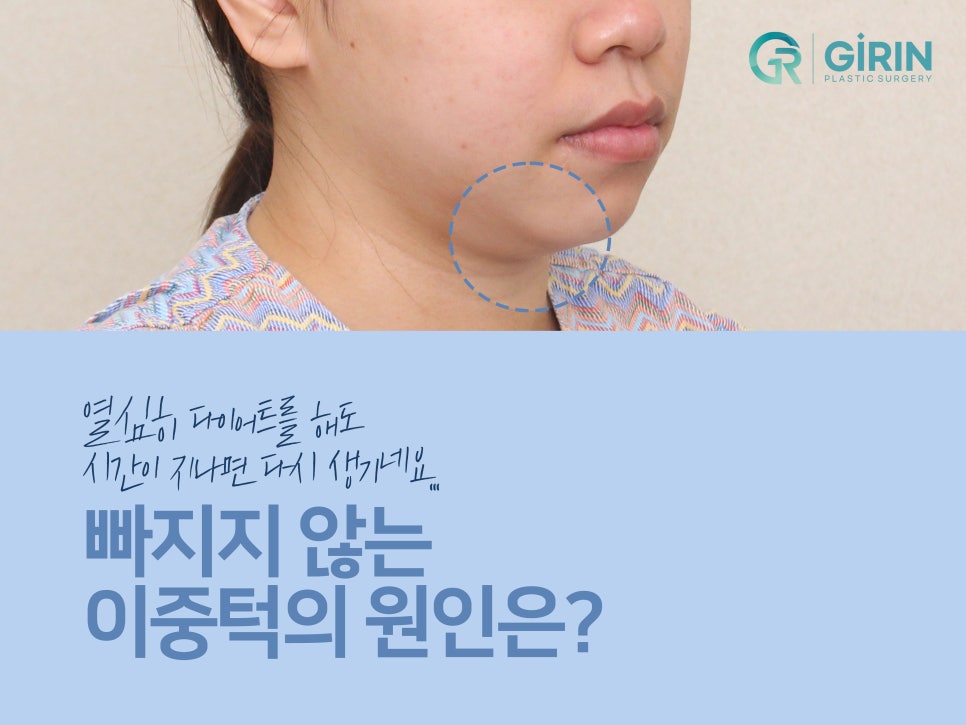 이중턱지방흡입 하나로 어렵다면? 관련 이미지 3
