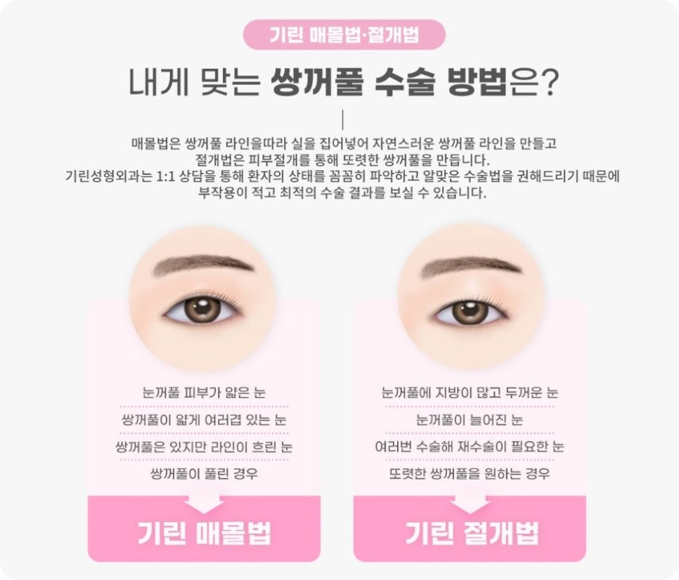 쌍수가격? 의미 없는 이유 관련 이미지 4