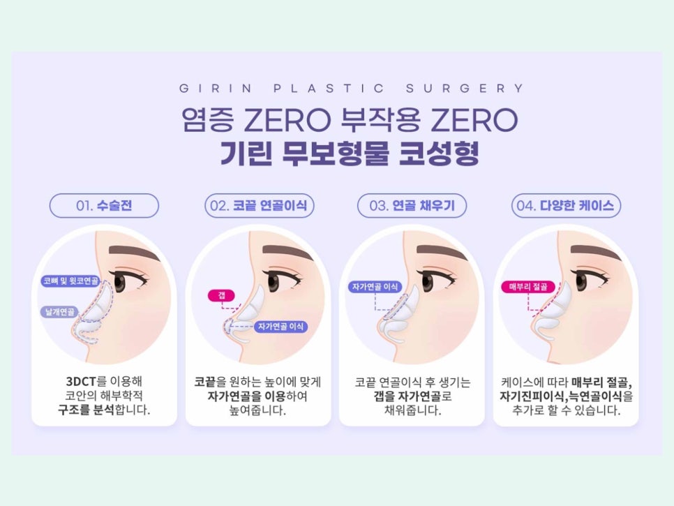 강남역성형외과유명한곳 얼굴에 맞춰 조화롭게 관련 이미지 9