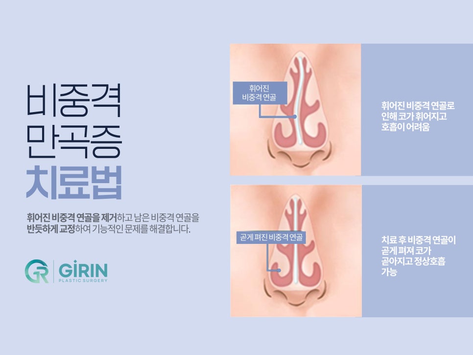 강남성형외과순위 선택은 신중하게 관련 이미지 8