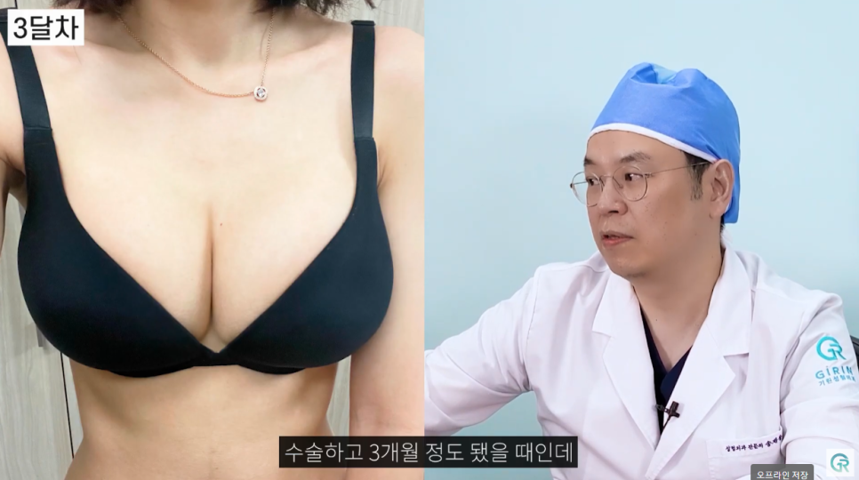 [기린성형외과의원] 자연스럽고 만족스러운 결과_마른체형의 가슴성형 수술일지 관련 이미지 9