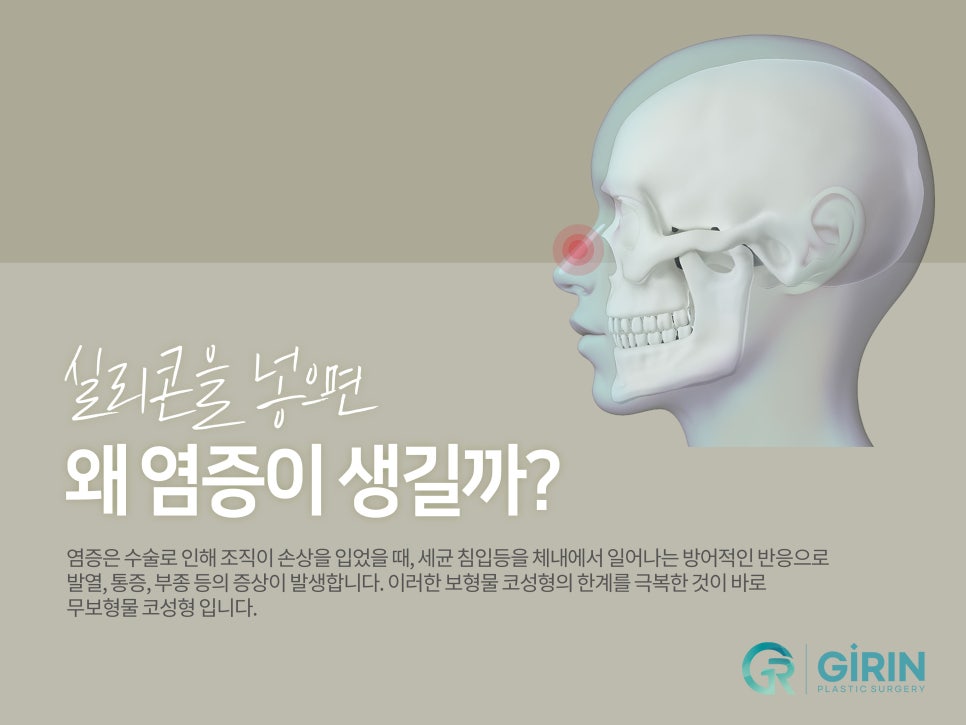 신논현성형외과 선택하고 싶다면 관련 이미지 7