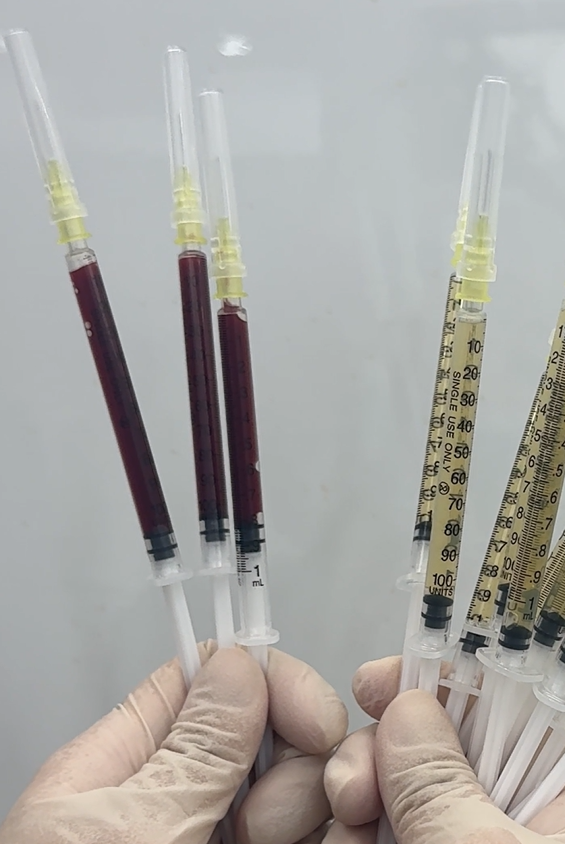 일요일에도 리프팅 가능한 이유 기린성형외과 관련 이미지 11