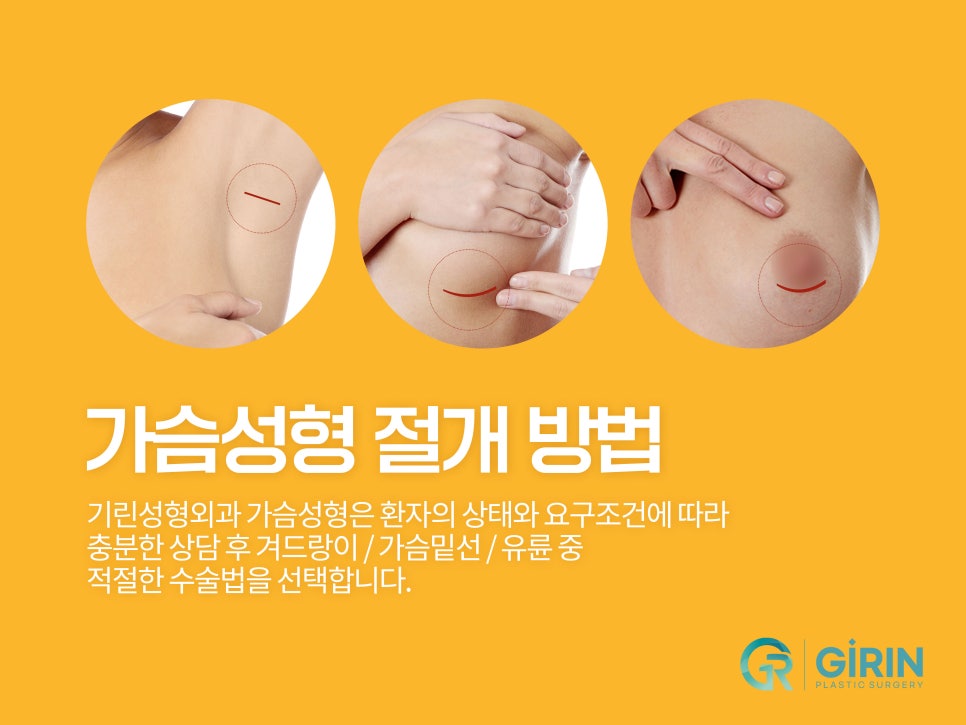 모티바가슴성형후기 세심하게 살펴보며 관련 이미지 8