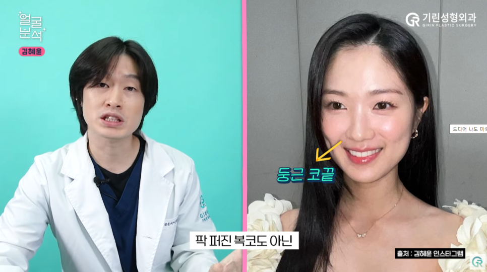 [기린성형외과의원] 선재 업고 튄 임솔 비주얼_선업튀 2탄 김혜윤 얼굴분석 관련 이미지 4