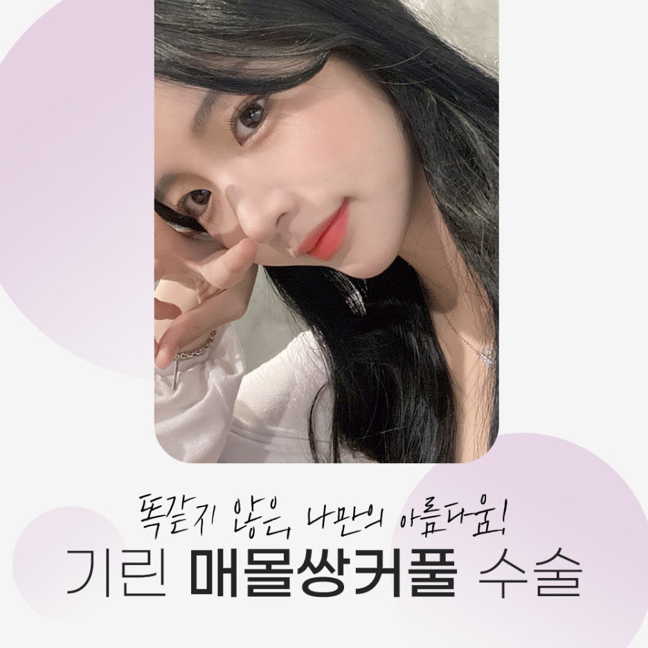 매몰 쌍꺼풀 생기있는 매력적인 이미지 관련 이미지 8